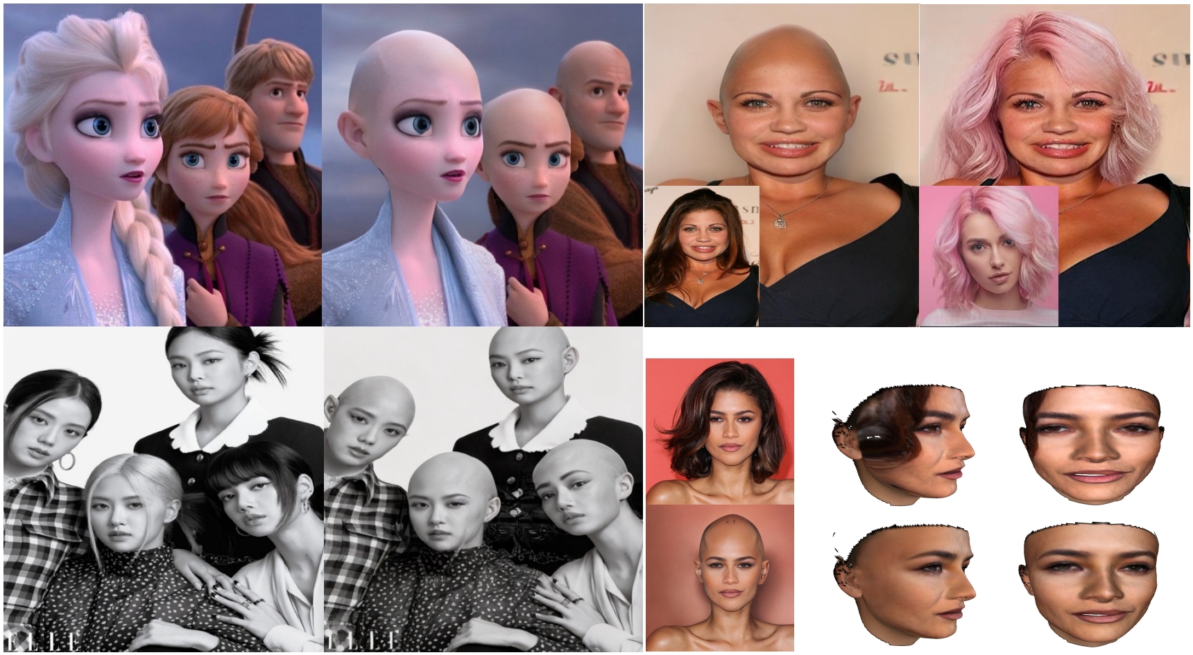 Diffusion-based Hair Removal